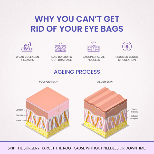 Claréa Glow® Red Light Therapy + EMS To Erase Eye Bags