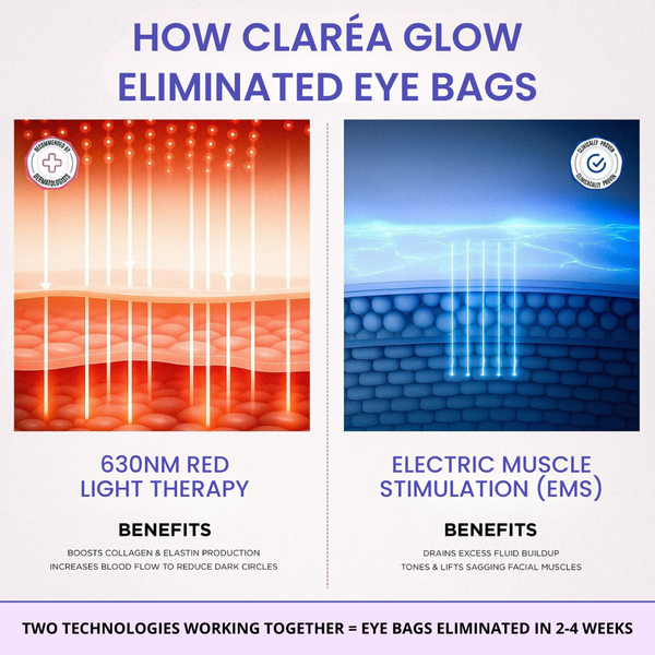 Claréa Glow® Red Light Therapy + EMS To Erase Eye Bags