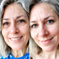 Claréa Glow® Red Light Therapy + EMS To Erase Eye Bags