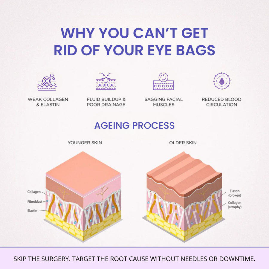Claréa Glow® Red Light Therapy + EMS To Erase Eye Bags