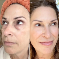 Claréa Glow® Red Light Therapy + EMS To Erase Eye Bags