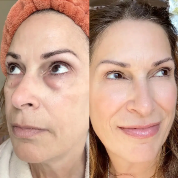 Claréa Glow® Red Light Therapy + EMS To Erase Eye Bags