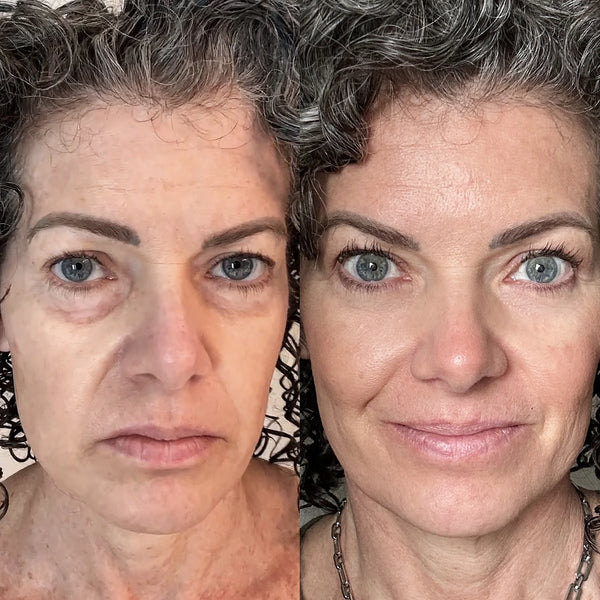 Claréa Glow® Red Light Therapy + EMS To Erase Eye Bags